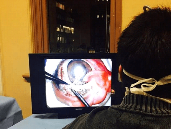 Teaching Glaucoma Surgery to the Surgeons of Tomorrow